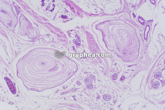 Peau du doigt avec corpuscules de Pacini x10 - gryphea.org